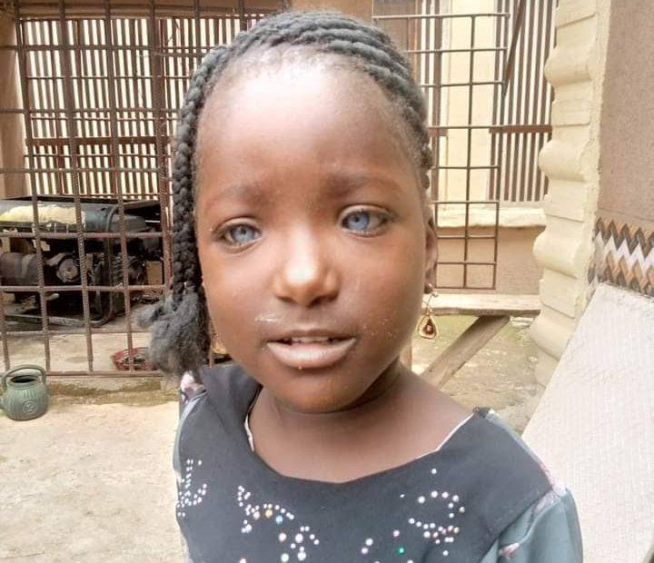 Kaosara: Nigerians rally round girl whose father rejected her due to her blue eyes