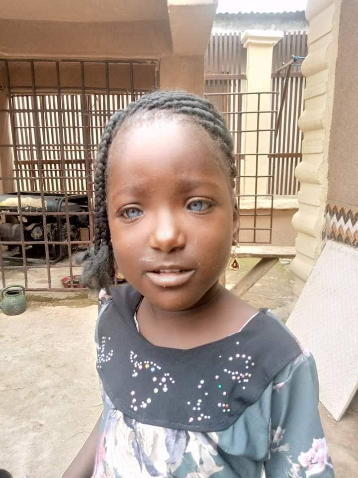 Kaosara: Nigerians rally round girl whose father rejected her due to her blue eyes