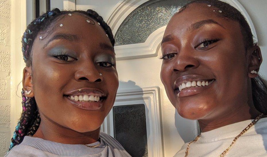 Conjoined Twins: 'We Always Knew We Were Different'