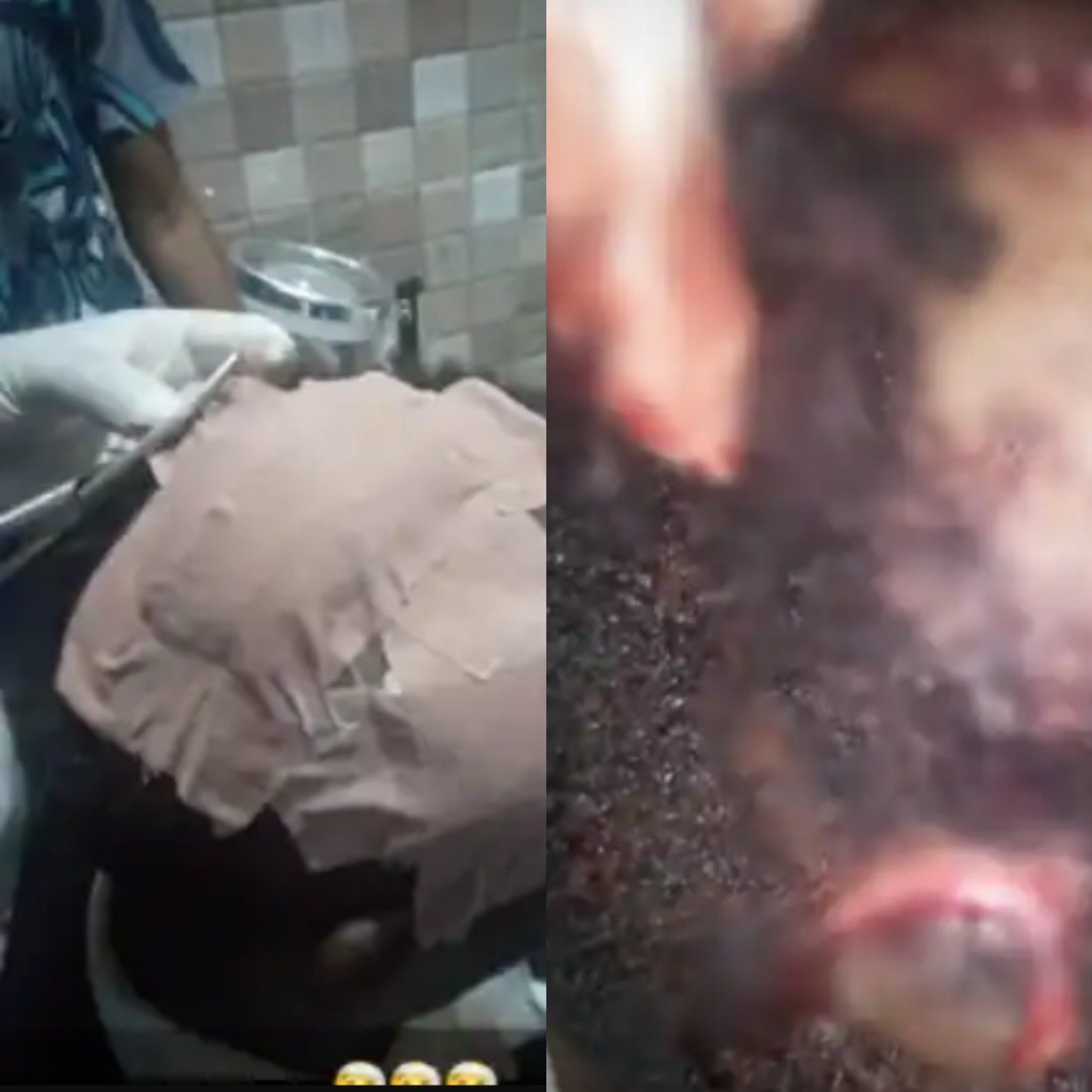 Caterer Allegedly Attacked By Groom’s Brother Over Small Chops At Wedding (graphic photos)
