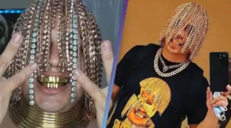 Mexico: Popular musician surgically implants gold hair into his head, see photos