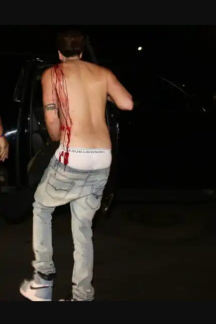 4 people shot at Justin Bieber's after-party in Los Angeles (graphic photo)