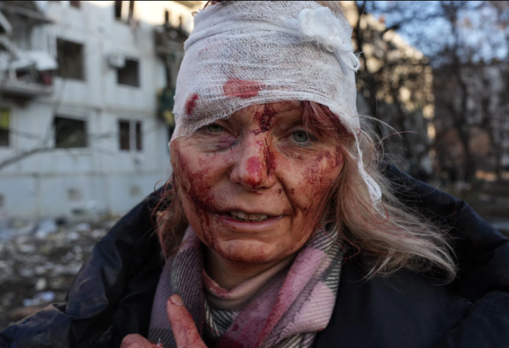 Heartbreaking scenes as deadly missile strikes plunge Ukraine into bloodshed after Putin declared war on Ukraine(Photos)