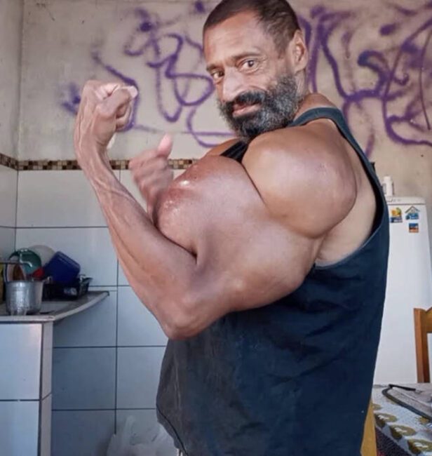 Popular Brazilian Hulk bodybuilder dies after injecting his enormous biceps