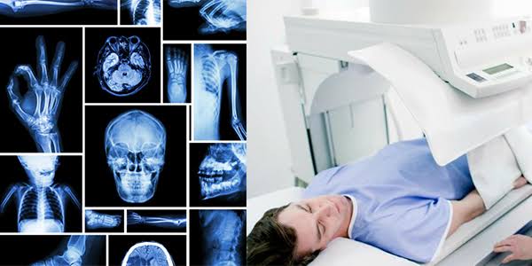 A Closer Look at X-Ray Technology: Benefits and Challenges