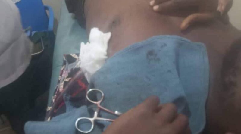 UNIJOS Student Fighting for Life After Being Stabbed by Female Neighbour for 'Making Noise'