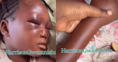 Eight year old left with swollen eyes and hands after she was assaulted by her aunt