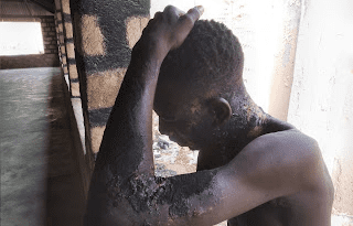 Lady pours hot cooking oil on man over N100 in Adamawa