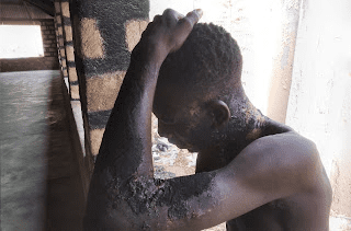 Lady pours hot cooking oil on man over N100 in Adamawa